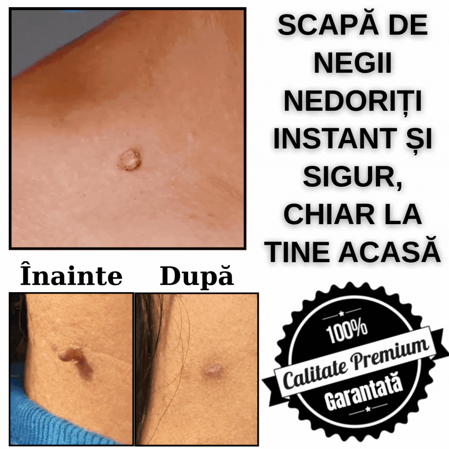 Dispozitiv Pentru Eliminearea Semnelor ClearTag™
