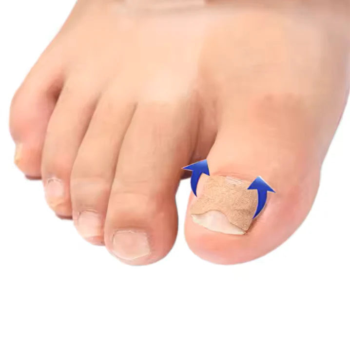 Plasture unghii NailPatch