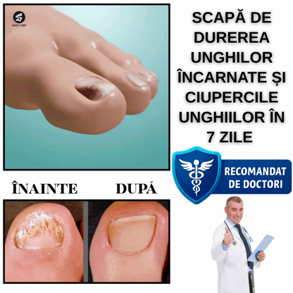 Plasture unghii NailPatch