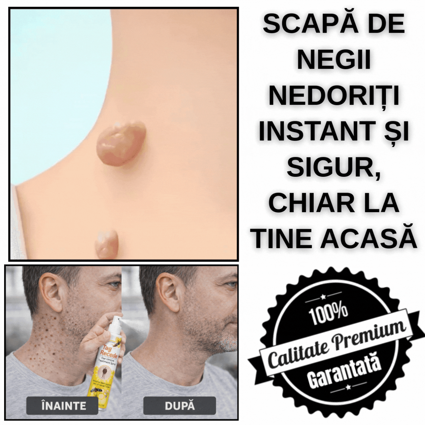 Spray Tratament cu Venin de Albine - BeeDerm™