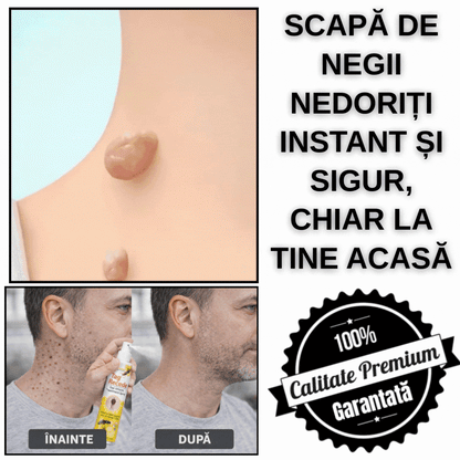 Spray Tratament cu Venin de Albine - BeeDerm™