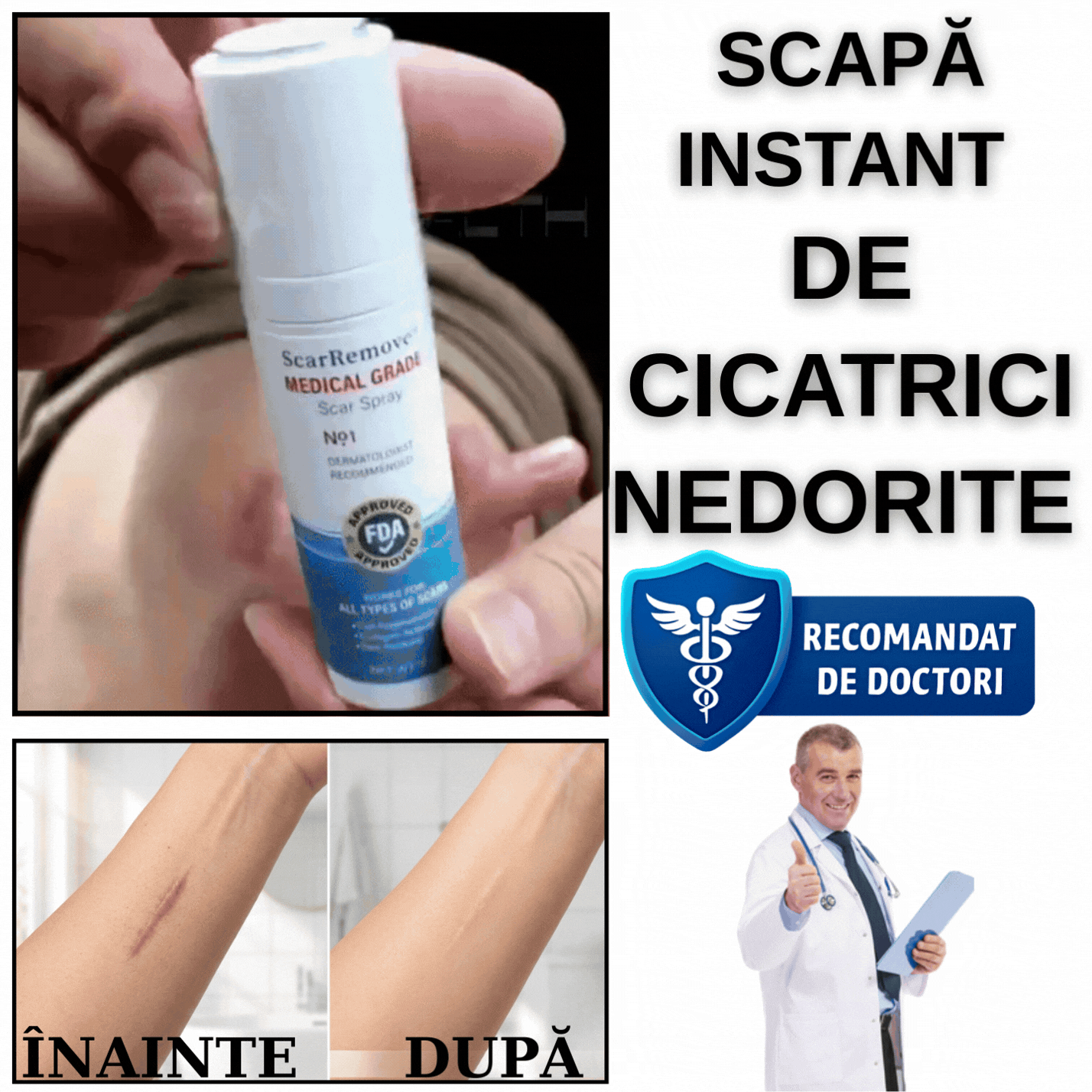 Scapă De Cicatrici Instant - SkarHide